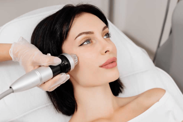 6 Questions To Ask Before Booking RF Microneedling