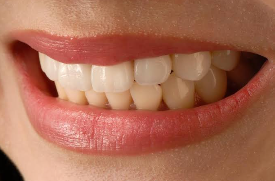 Cosmetic Dentistry For Teeth That Look Too Flat Or Square