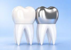 5 Questions To Ask About White Zirconia Crowns For Baby Teeth